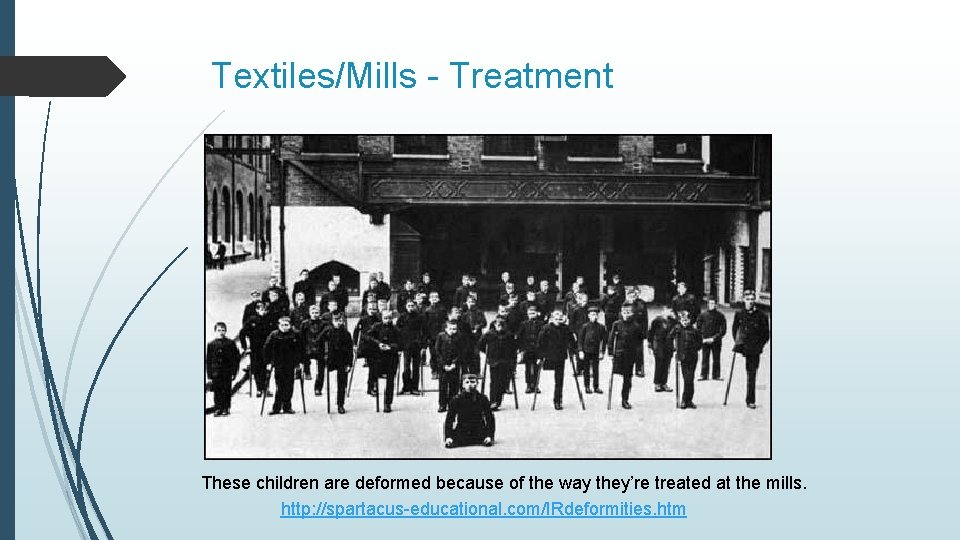 Textiles/Mills - Treatment These children are deformed because of the way they’re treated at