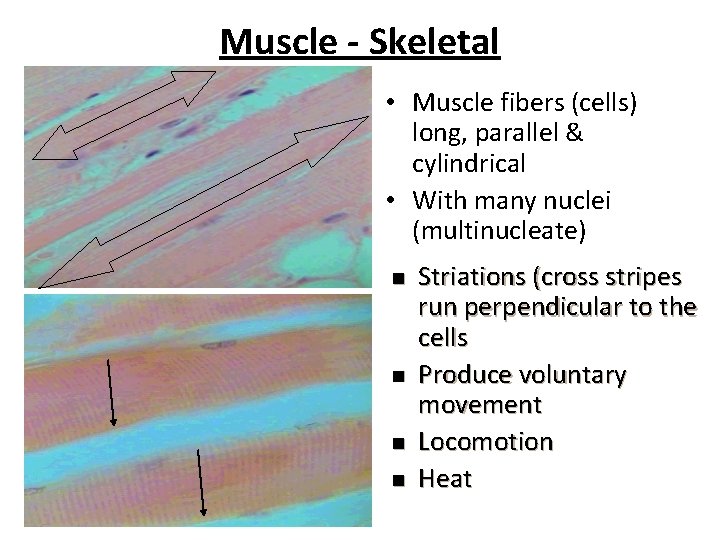 Muscle - Skeletal • Muscle fibers (cells) long, parallel & cylindrical • With many
