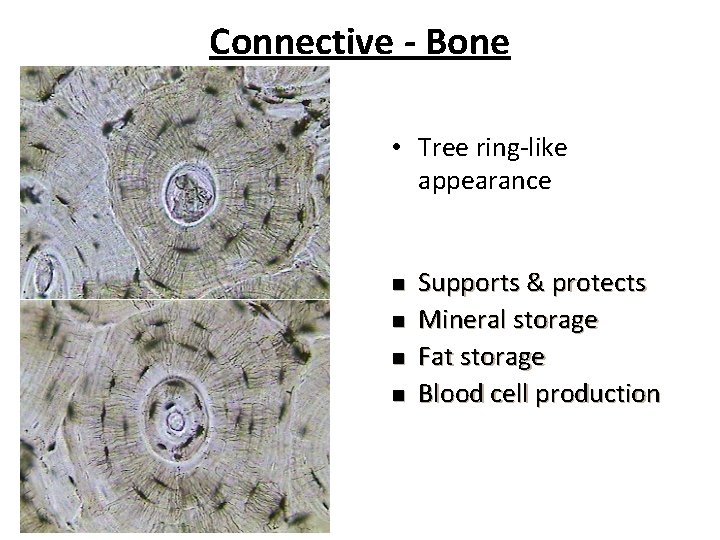 Connective - Bone • Tree ring-like appearance n n Supports & protects Mineral storage