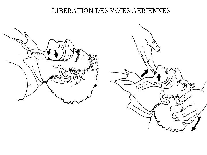 LIBERATION DES VOIES AERIENNES 