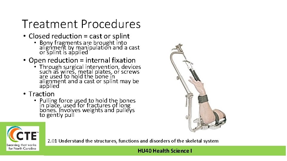 Treatment Procedures • Closed reduction = cast or splint • Bony fragments are brought