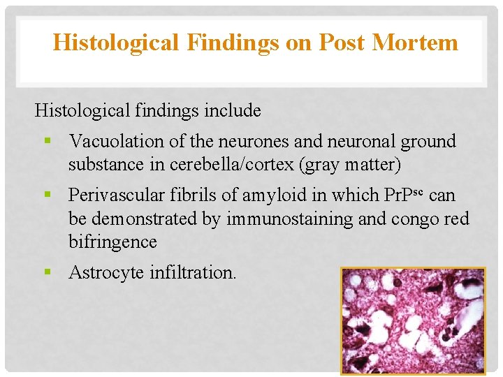 Histological Findings on Post Mortem Histological findings include § Vacuolation of the neurones and