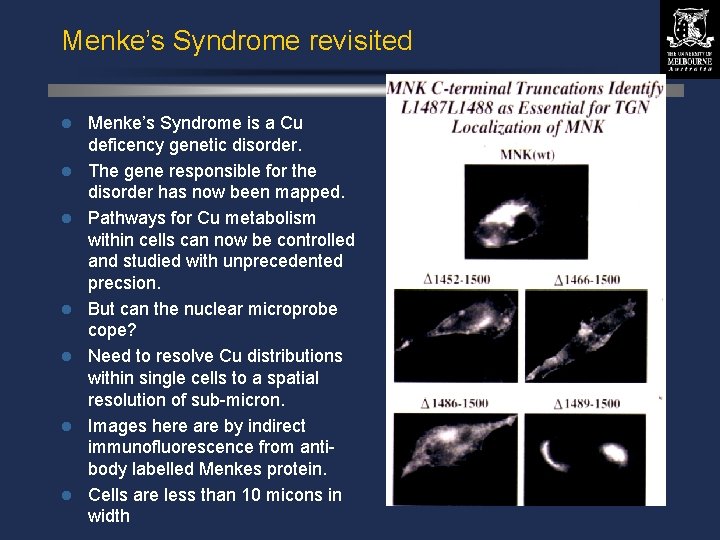 Menke’s Syndrome revisited Menke’s Syndrome is a Cu deficency genetic disorder. l The gene