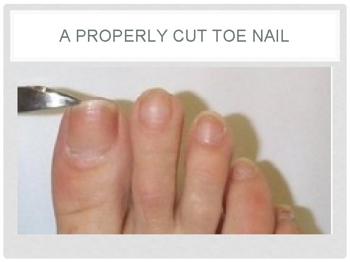 A PROPERLY CUT TOE NAIL A PROPERLY CUT TOE NAIL