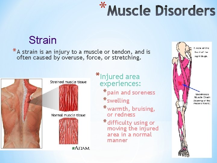 * Strain * A strain is an injury to a muscle or tendon, and