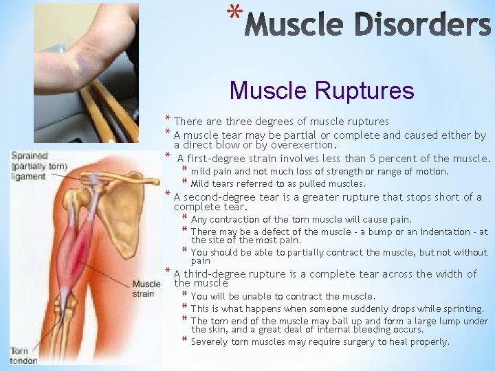 * Muscle Ruptures * There are three degrees of muscle ruptures * A muscle