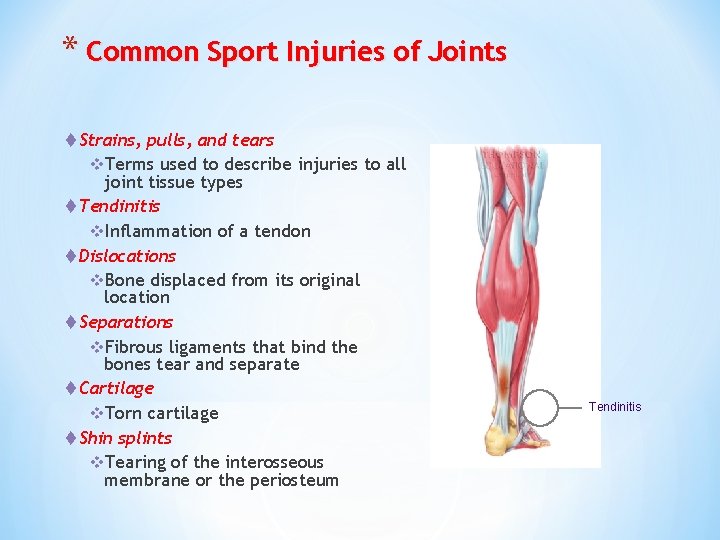 * Common Sport Injuries of Joints t Strains, pulls, and tears v. Terms used