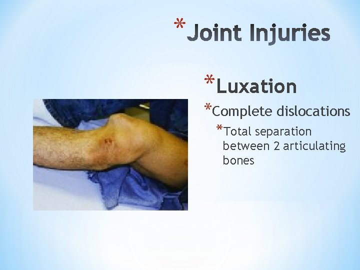 * *Luxation *Complete dislocations *Total separation between 2 articulating bones 