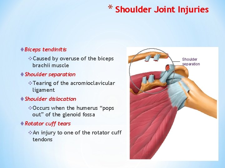 * Shoulder Joint Injuries t Biceps tendinitis v. Caused by overuse of the biceps