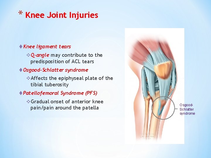 * Knee Joint Injuries t Knee ligament tears v. Q-angle may contribute to the