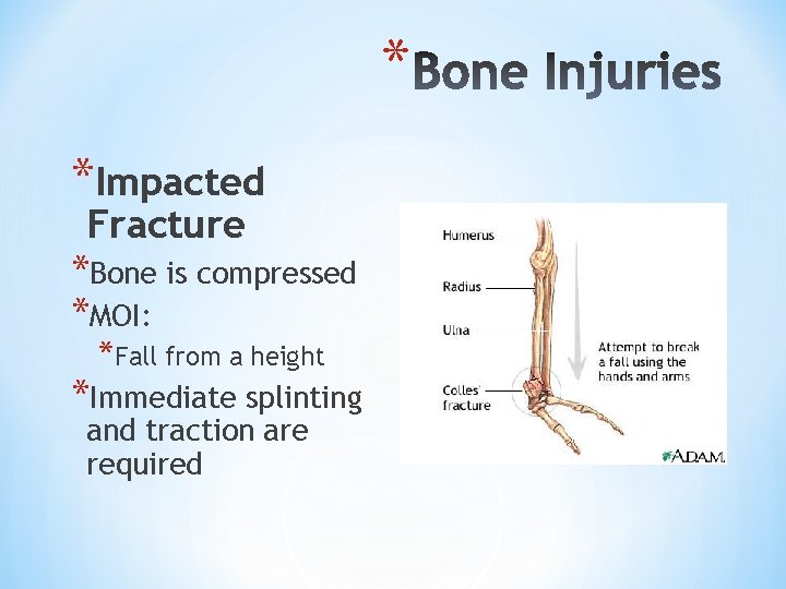 * *Impacted Fracture *Bone is compressed *MOI: *Fall from a height *Immediate splinting and