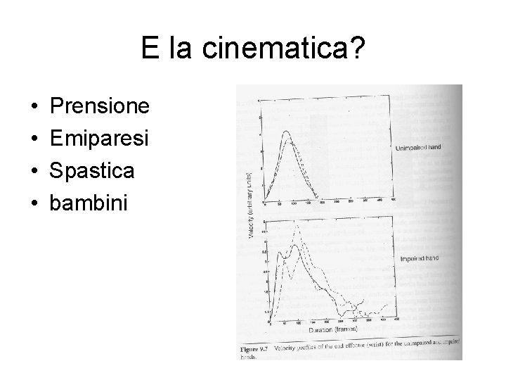 E la cinematica? • • Prensione Emiparesi Spastica bambini 