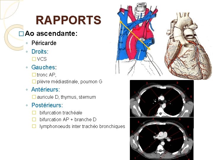 RAPPORTS � Ao ascendante: ◦ Péricarde ◦ Droits: � VCS ◦ Gauches: � tronc