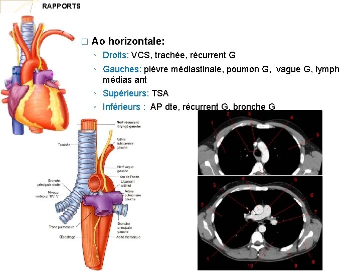 RAPPORTS � Ao horizontale: ◦ Droits: VCS, trachée, récurrent G ◦ Gauches: plévre médiastinale,