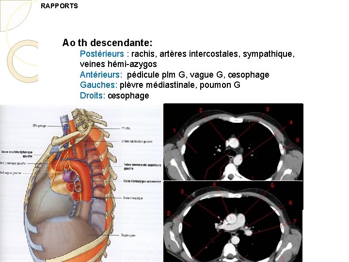 RAPPORTS Ao th descendante: Postérieurs : rachis, artères intercostales, sympathique, veines hémi-azygos Antérieurs: pédicule