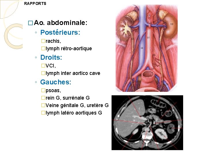 RAPPORTS � Ao. abdominale: ◦ Postérieurs: �rachis, �lymph rétro-aortique ◦ Droits: �VCI, �lymph inter