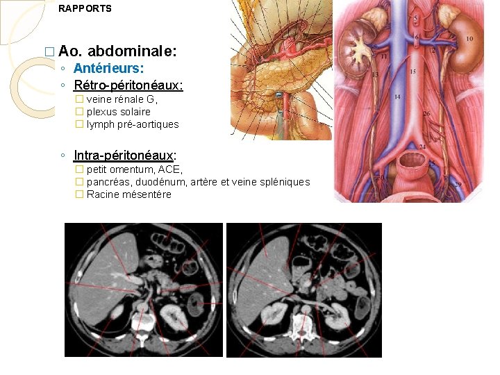 RAPPORTS � Ao. abdominale: ◦ Antérieurs: ◦ Rétro-péritonéaux: � veine rénale G, � plexus