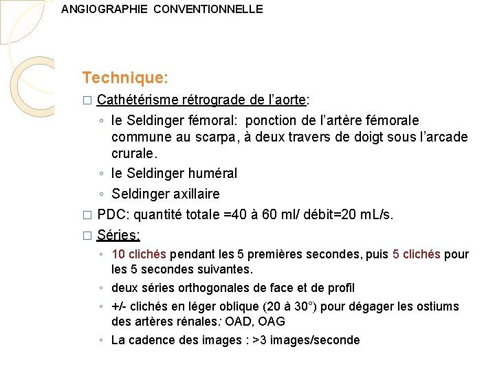 ANGIOGRAPHIE CONVENTIONNELLE Technique: Cathétérisme rétrograde de l’aorte: ◦ le Seldinger fémoral: ponction de l’artère