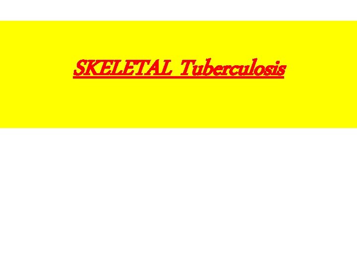 SKELETAL Tuberculosis 