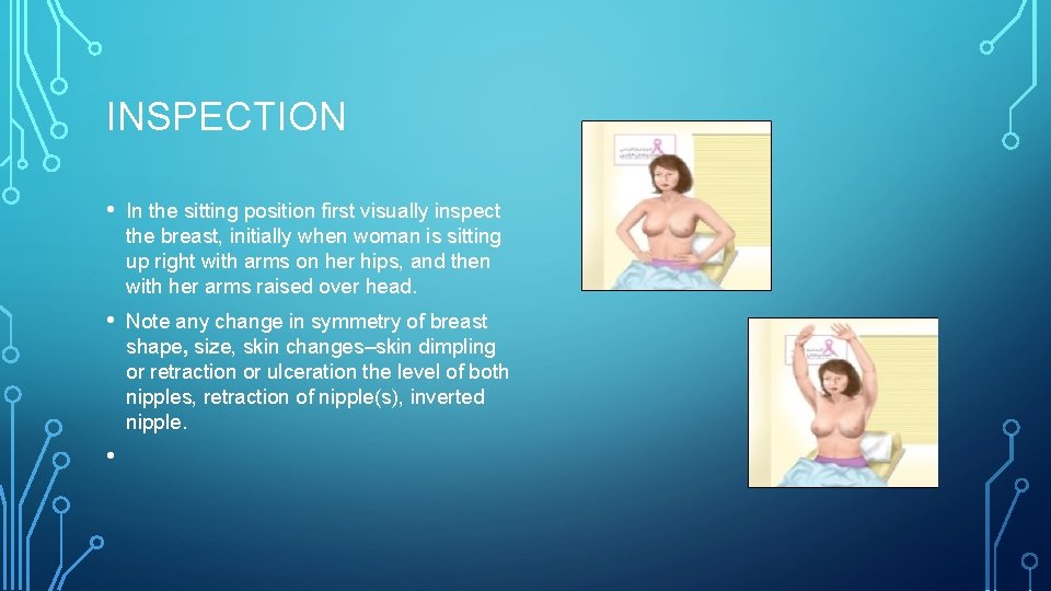 INSPECTION • In the sitting position first visually inspect the breast, initially when woman