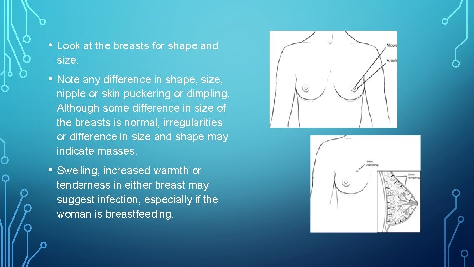  • Look at the breasts for shape and size. • Note any difference