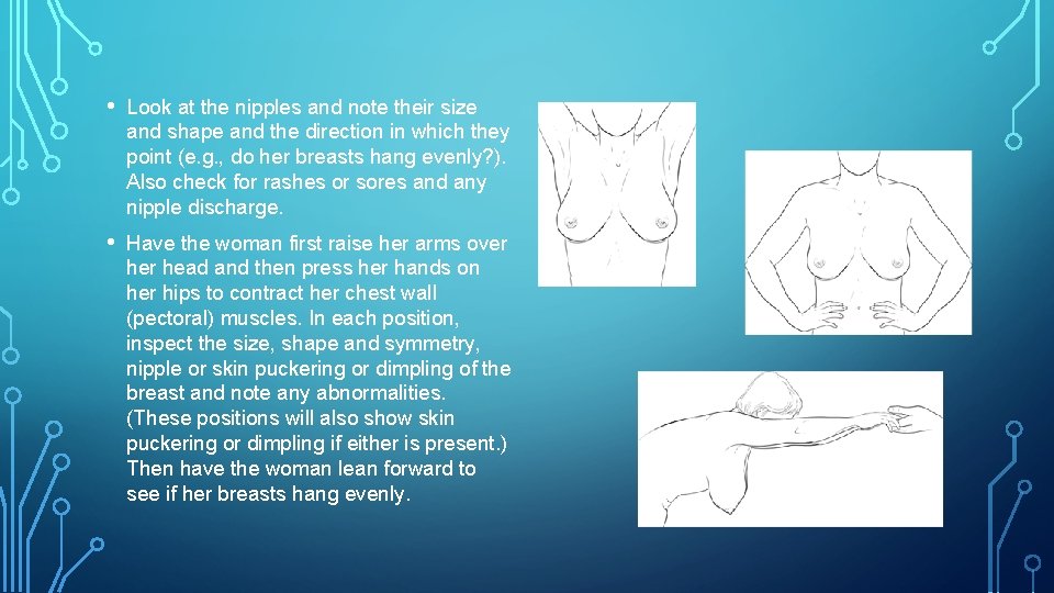  • Look at the nipples and note their size and shape and the