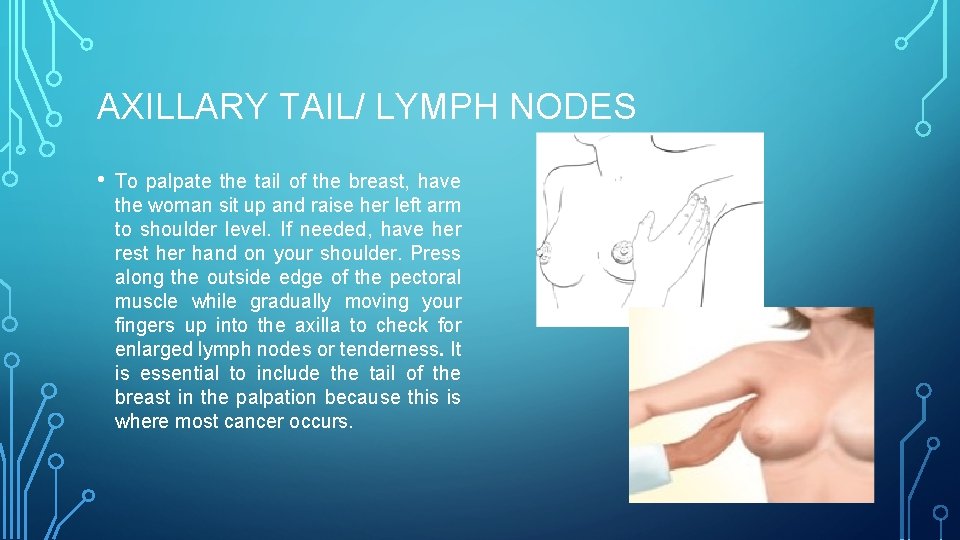 AXILLARY TAIL/ LYMPH NODES • To palpate the tail of the breast, have the