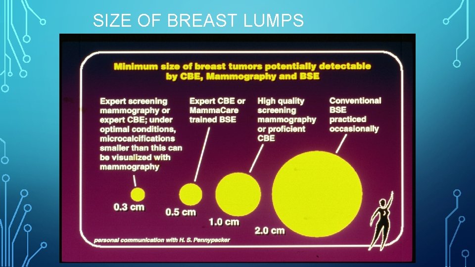 SIZE OF BREAST LUMPS 