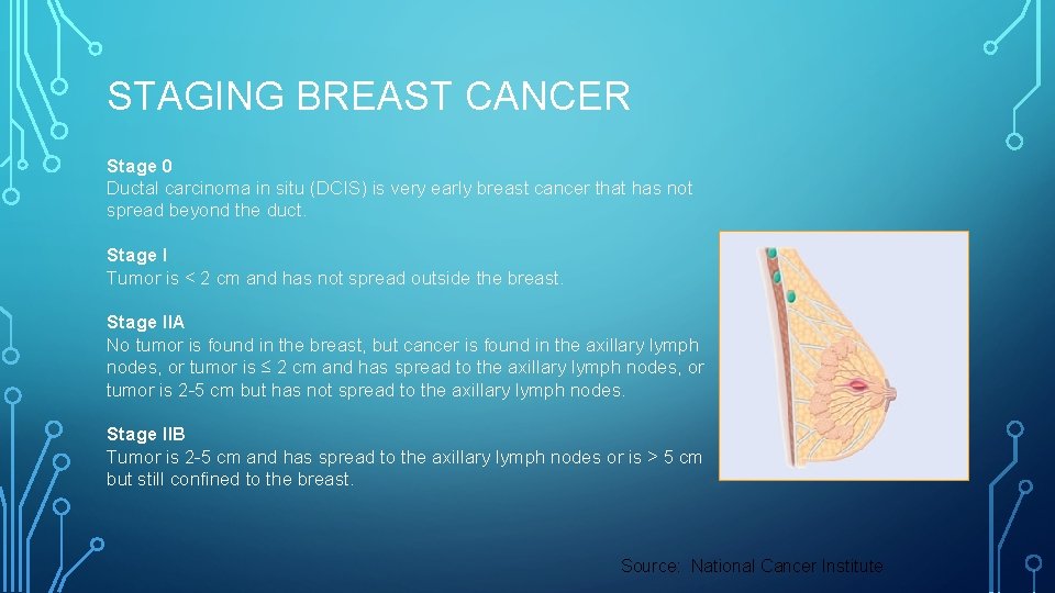 STAGING BREAST CANCER Stage 0 Ductal carcinoma in situ (DCIS) is very early breast