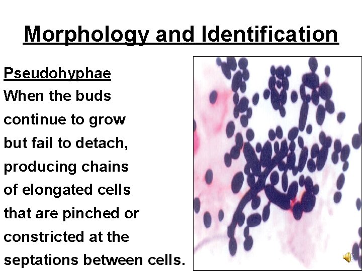 Morphology and Identification Pseudohyphae When the buds continue to grow but fail to detach,