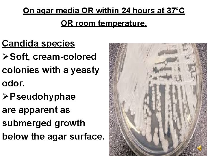 On agar media OR within 24 hours at 37°C OR room temperature, Candida species
