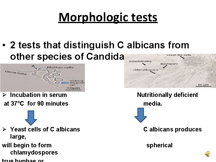 Morphologic tests • 2 tests that distinguish C albicans from other species of Candida.