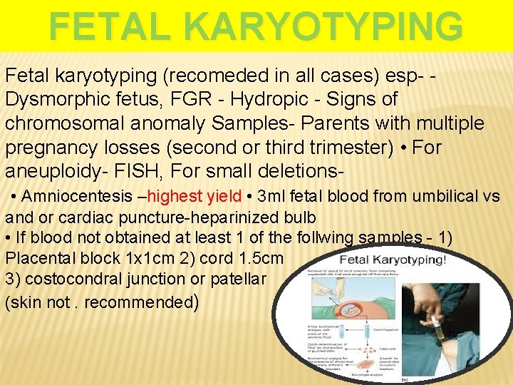 FETAL KARYOTYPING Fetal karyotyping (recomeded in all cases) esp- Dysmorphic fetus, FGR - Hydropic