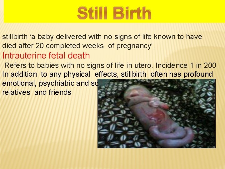 Still Birth stillbirth ‘a baby delivered with no signs of life known to have