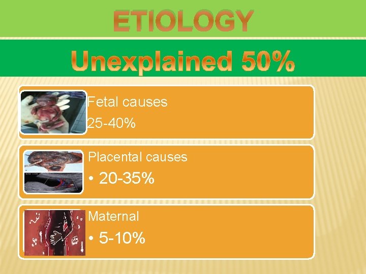 ETIOLOGY Fetal causes 25 -40% Placental causes • 20 -35% Maternal • 5 -10%
