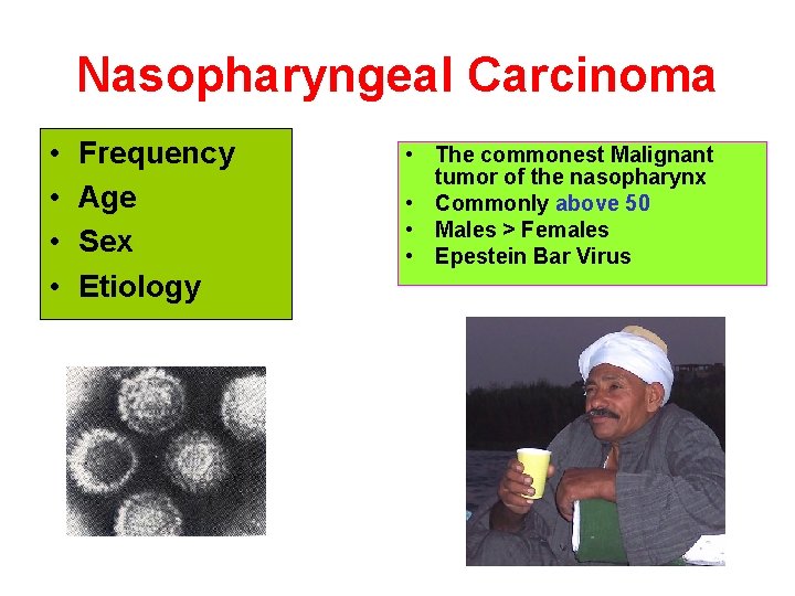 Nasopharyngeal Carcinoma • • Frequency Age Sex Etiology • The commonest Malignant tumor of