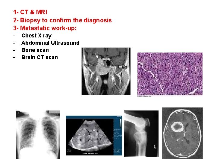 1 - CT & MRI 2 - Biopsy to confirm the diagnosis 3 -