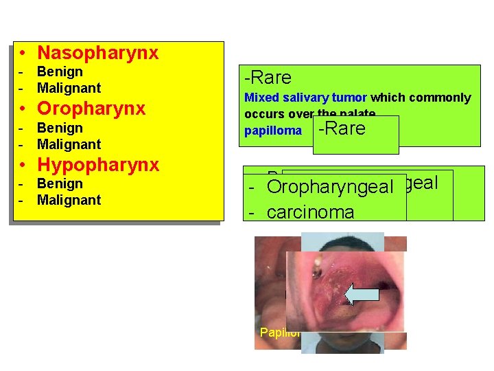  • Nasopharynx - Benign - Malignant • Oropharynx - Benign - Malignant •