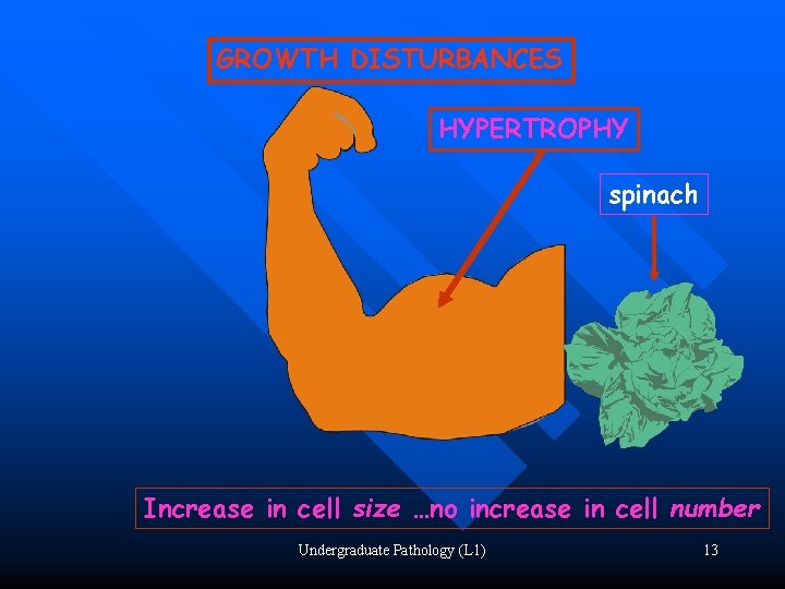 GROWTH DISTURBANCES HYPERTROPHY spinach Increase in cell size …no increase in cell number Undergraduate