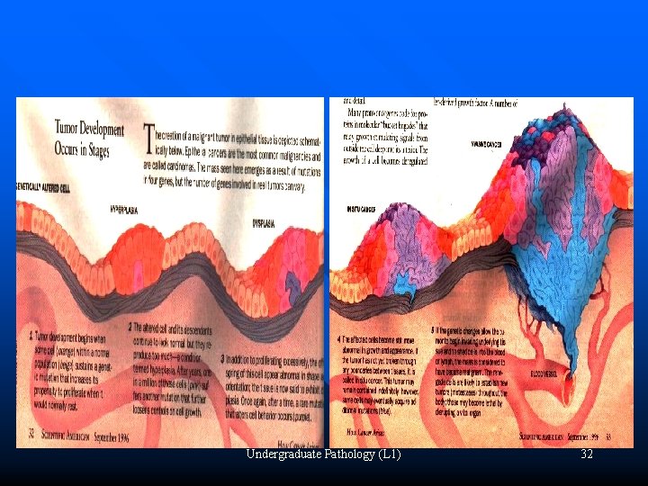 Undergraduate Pathology (L 1) 32 