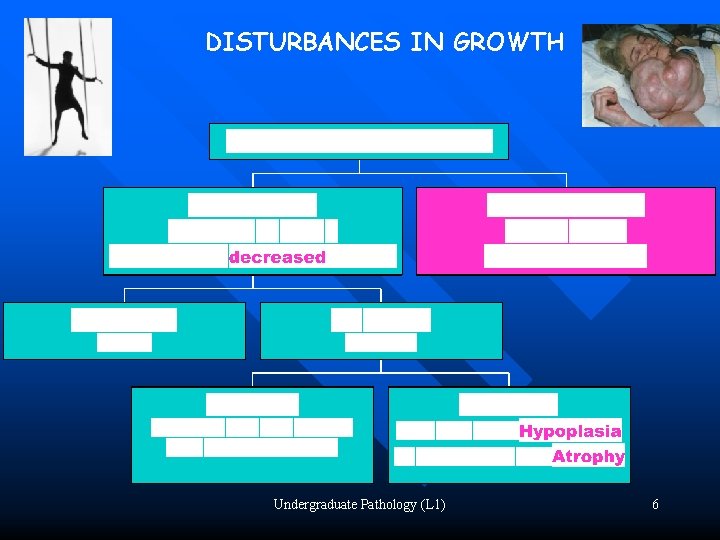 DISTURBANCES IN GROWTH Undergraduate Pathology (L 1) 6 