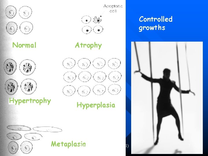 Controlled growths Normal Atrophy Hyperplasia Metaplasia Undergraduate Pathology (L 1) 7 