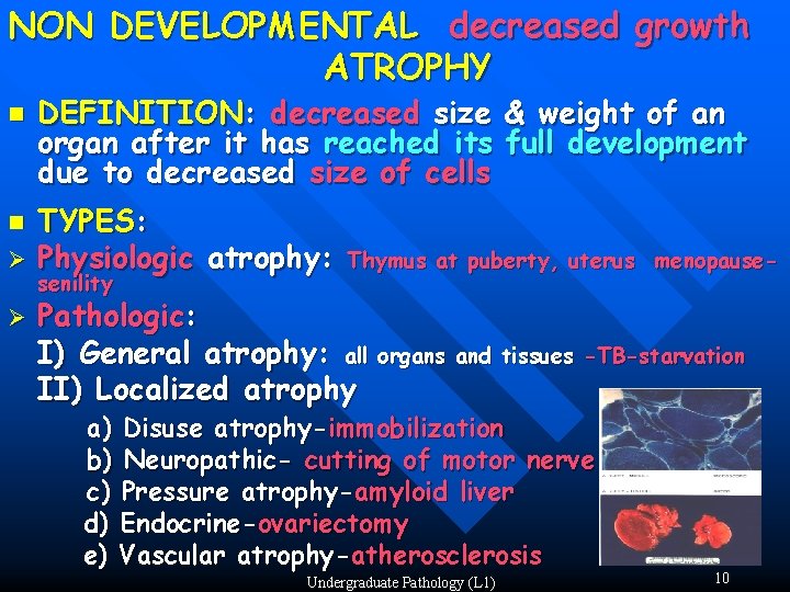 NON DEVELOPMENTAL decreased growth ATROPHY n n Ø Ø DEFINITION: decreased size & weight