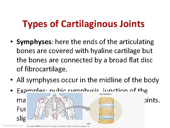 Types of Cartilaginous Joints • Symphyses: here the ends of the articulating bones are