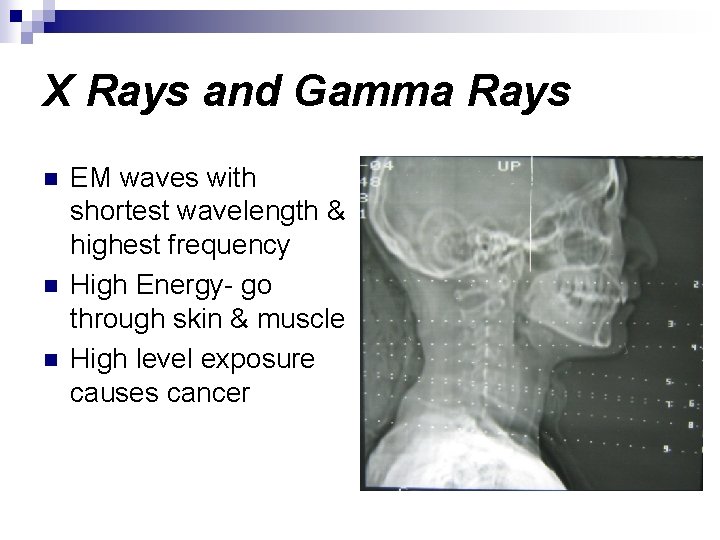 X Rays and Gamma Rays n n n EM waves with shortest wavelength &