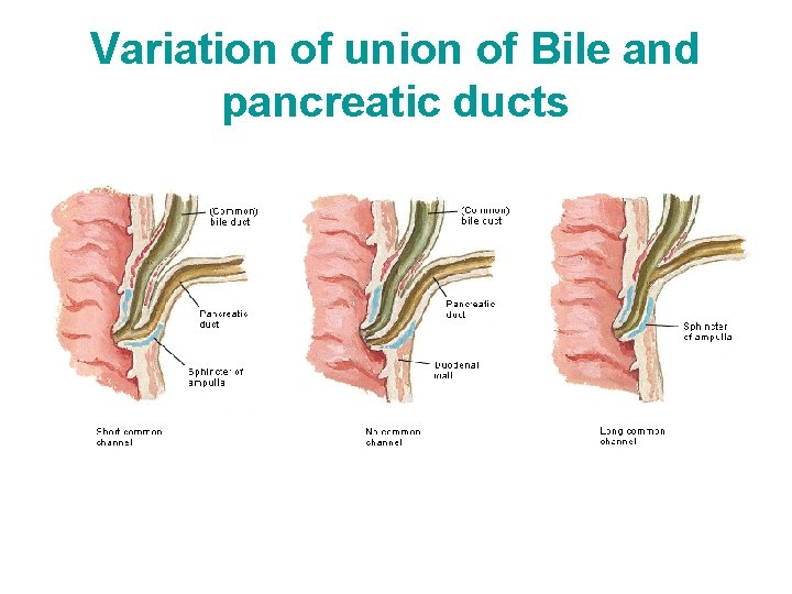 Variation of union of Bile and pancreatic ducts 