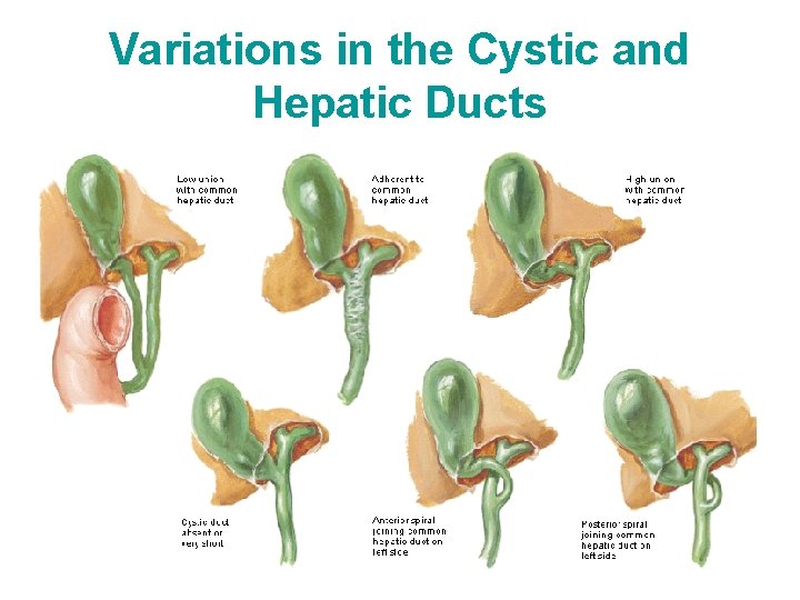 Variations in the Cystic and Hepatic Ducts 
