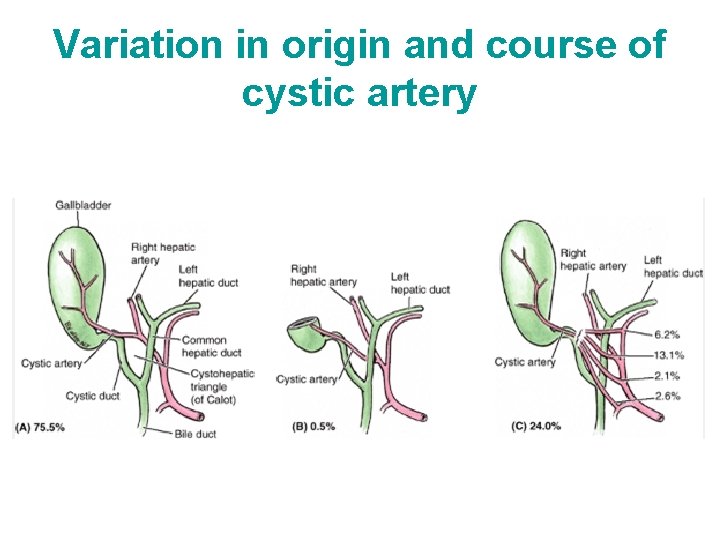 Variation in origin and course of cystic artery 