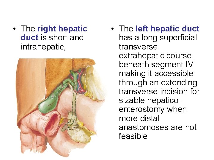 • The right hepatic duct is short and intrahepatic, • The left hepatic