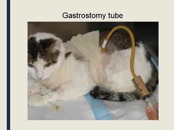 Gastrostomy tube 